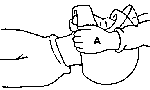 helm1